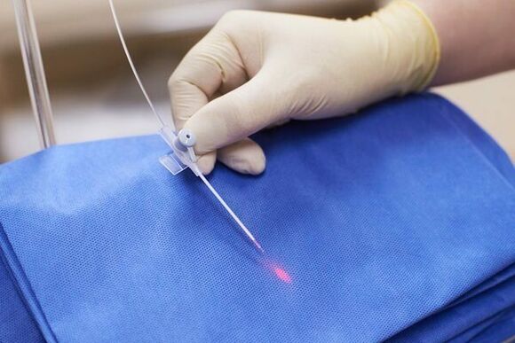 In sommige gevallen wordt lasertherapie gebruikt voor chronische prostatitis