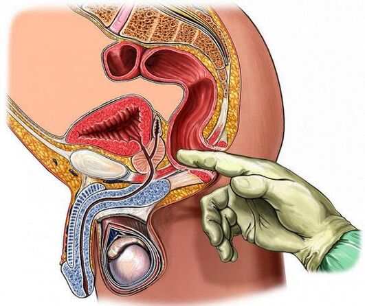 Diagnose van prostatitis