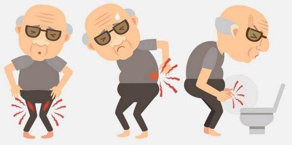Symptomen van prostatitis