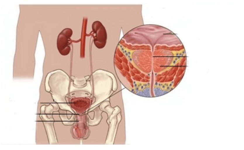 prostatitis bij mannen