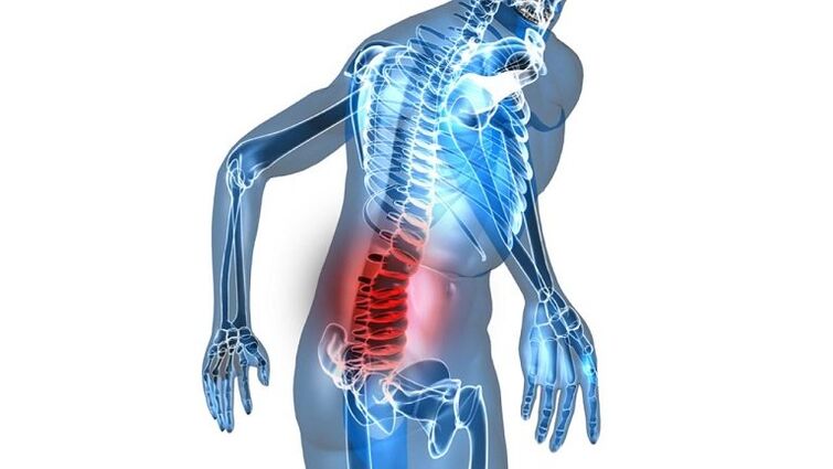 Ontsteking met congestieve prostatitis
