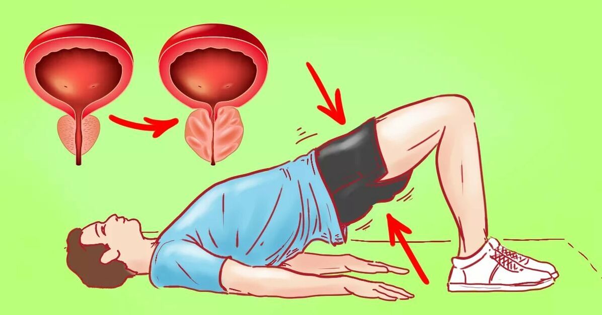 Oefeningen voor prostatitis